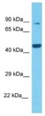 Western Blot: TRIM46 Antibody [NBP3-10162]