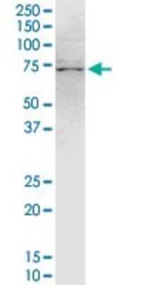 Western Blot: TRIM47 Antibody (3C8) [H00091107-M02]