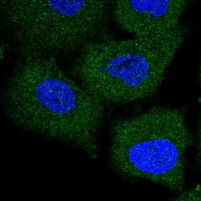 Immunocytochemistry/ Immunofluorescence: TRIM47 Antibody [NBP1-83353]