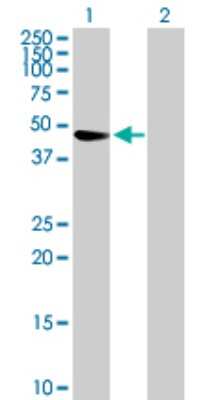 Western Blot: TRIM47 Antibody [H00091107-B01P]