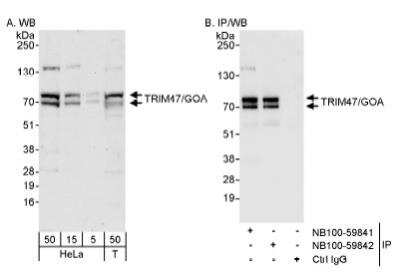 Western Blot: TRIM47 Antibody [NB100-59841]