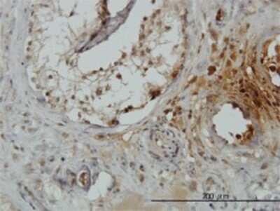 Immunohistochemistry-Paraffin: TRIM49 Antibody (2E5) [H00057093-M01]
