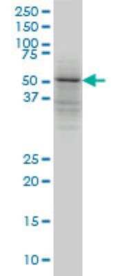 Western Blot: TRIM49 Antibody (3A10) [H00057093-M02]