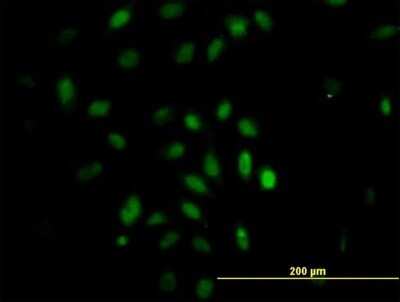 Immunocytochemistry/ Immunofluorescence: TRIM49 Antibody (3C7) [H00057093-M05]