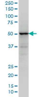 Western Blot: TRIM49 Antibody (3C7) [H00057093-M05]