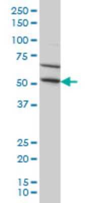 Western Blot: TRIM49 Antibody (3H8) [H00057093-M03]