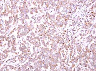 Immunohistochemistry-Paraffin: TRIM49 Antibody [NBP2-20721]