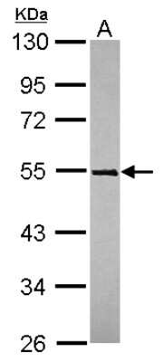 Western Blot: TRIM49 Antibody [NBP2-20721]