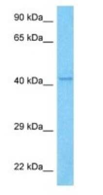 Western Blot: TRIM49B Antibody [NBP3-09223]