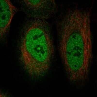 Immunocytochemistry/ Immunofluorescence: TRIM49D1 Antibody [NBP3-17183]