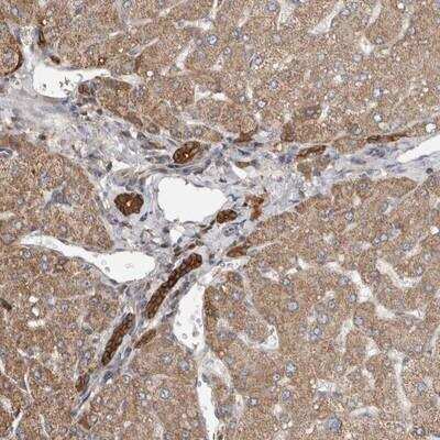 Immunohistochemistry: TRIM5 Antibody [NBP1-87120]