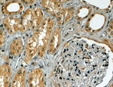 Immunohistochemistry-Paraffin: TRIM5 Antibody [NB100-2474]