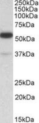 Western Blot: TRIM5 Antibody [NB100-1226]