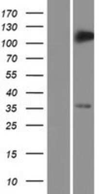 Western Blot: TRIM5 Overexpression Lysate [NBP2-09940]