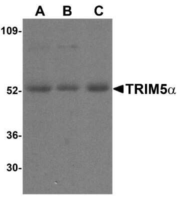 Western Blot: TRIM5 alpha AntibodyBSA Free [NBP1-77207]