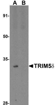 Western Blot: TRIM5 delta AntibodyBSA Free [NBP1-76603]