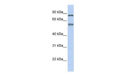 Western Blot: TRIM50 Antibody [NBP2-85994]