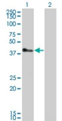 Western Blot: TRIM52 Antibody (6D5) [H00084851-M01]