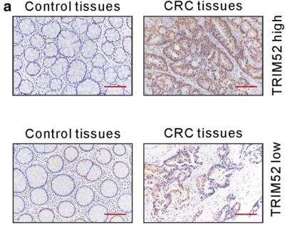 Immunohistochemistry: TRIM52 Antibody [NBP2-31651]