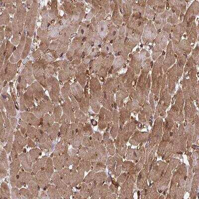 Immunohistochemistry-Paraffin: TRIM52 Antibody [NBP2-31651]