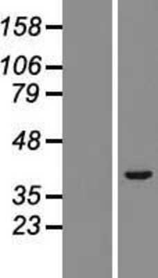 Western Blot: TRIM52 Overexpression Lysate [NBL1-17304]