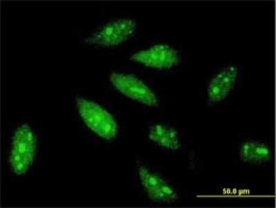 Immunocytochemistry/ Immunofluorescence: TRIM56 Antibody (4C5) [H00081844-M01]