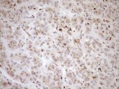 Immunohistochemistry: TRIM56 Antibody (OTI5A1) [NBP2-46232]