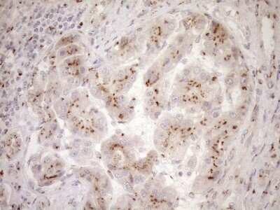 Immunohistochemistry: TRIM56 Antibody (OTI5A1) [NBP2-46232]
