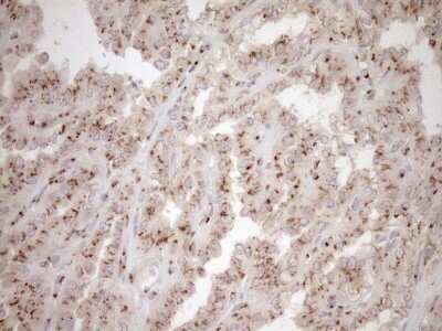Immunohistochemistry: TRIM56 Antibody (OTI5A1) [NBP2-46232]