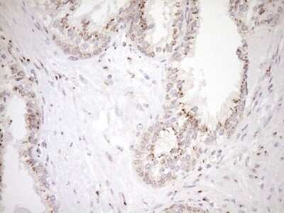 Immunohistochemistry: TRIM56 Antibody (OTI5A1) [NBP2-46232]