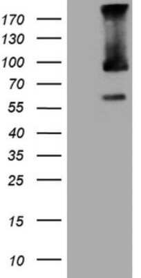 Western Blot: TRIM56 Antibody (OTI5A1) [NBP2-46232]