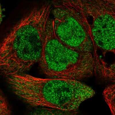 Immunocytochemistry/ Immunofluorescence: TRIM56 Antibody [NBP1-80829]