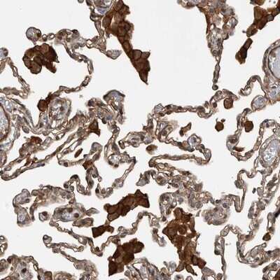 Immunohistochemistry-Paraffin: TRIM56 Antibody [NBP1-80829]