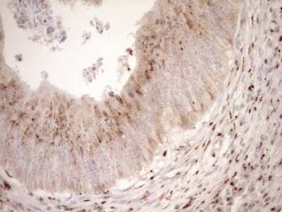 Immunohistochemistry: TRIM56 Antibody (OTI5A1) - Azide and BSA Free [NBP2-74613]