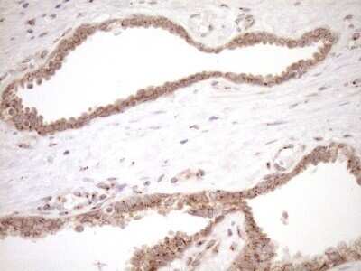 Immunohistochemistry: TRIM56 Antibody (OTI5A1) - Azide and BSA Free [NBP2-74613]