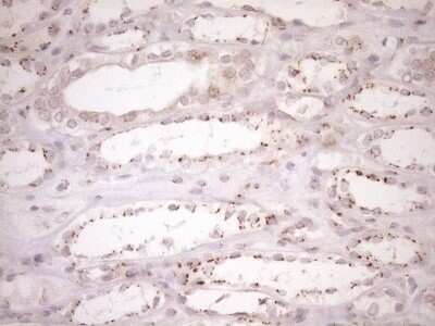 Immunohistochemistry: TRIM56 Antibody (OTI5A1) - Azide and BSA Free [NBP2-74613]