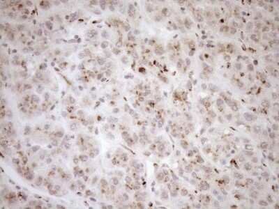 Immunohistochemistry: TRIM56 Antibody (OTI5A1) - Azide and BSA Free [NBP2-74613]