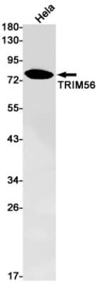 Western Blot: TRIM56 Antibody (S02-8A3) [NBP3-19795]