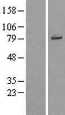 Western Blot: TRIM56 Overexpression Lysate [NBL1-17307]