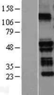 Western Blot: TRIM58 Overexpression Lysate [NBL1-17308]