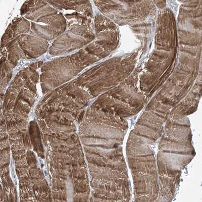 Immunohistochemistry: TRIM60 Antibody [NBP2-48644]