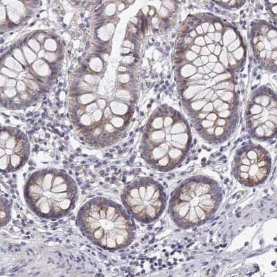 Immunohistochemistry: TRIM60 Antibody [NBP2-49338]