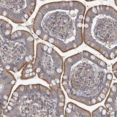 Immunohistochemistry-Paraffin: TRIM60 Antibody [NBP1-83494]