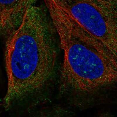 Immunocytochemistry/ Immunofluorescence: TRIM61 Antibody [NBP2-13485]