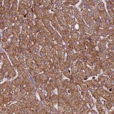 Immunohistochemistry-Paraffin: TRIM61 Antibody [NBP2-13485]