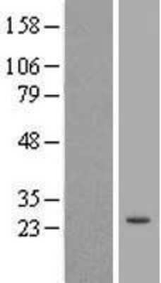 Western Blot: TRIM61 Overexpression Lysate [NBL1-17310]