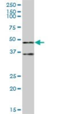 Western Blot: TRIM62 Antibody [H00055223-B01P]