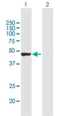 Western Blot: TRIM62 Antibody [H00055223-B01P]