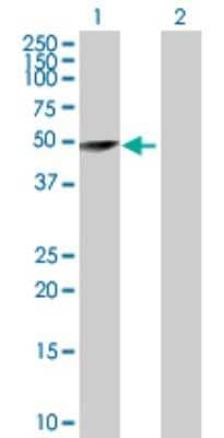 Western Blot: TRIM62 Antibody [H00055223-D01P]
