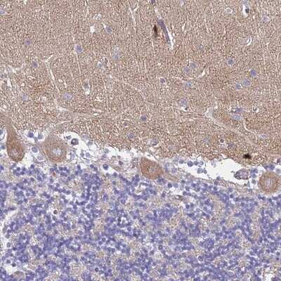 Immunohistochemistry-Paraffin: TRIM64A Antibody [NBP2-14548]